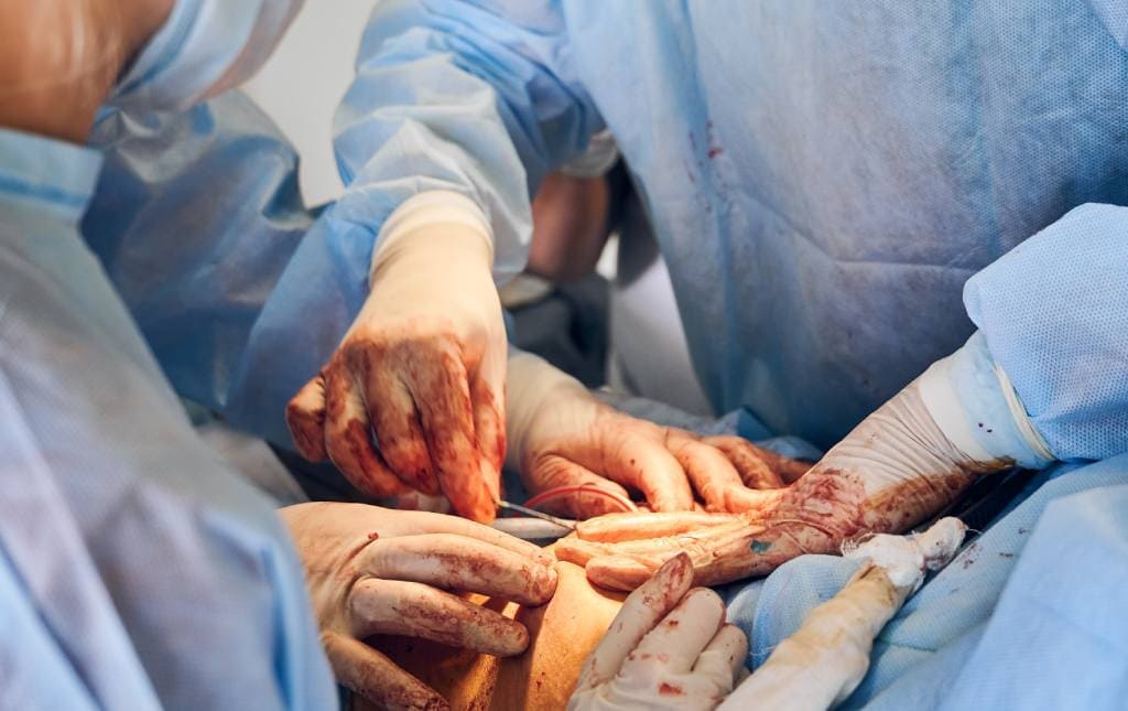 Cirugía gastrointestinal en edo de mex