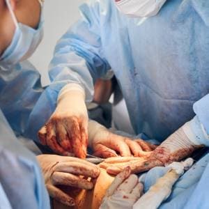 Cirugía gastrointestinal en edo de mex